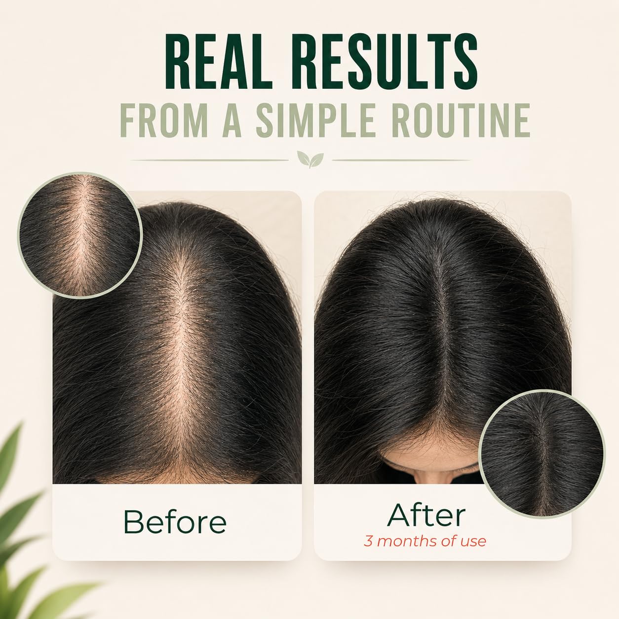 Konipl 100% Organic, Raw Batana oil for Hair Growth | Natural Cold Press Extraction Method | Dr Sebi Scalp Care Hair Shine treatment for Men & Women | No Burnt Smell