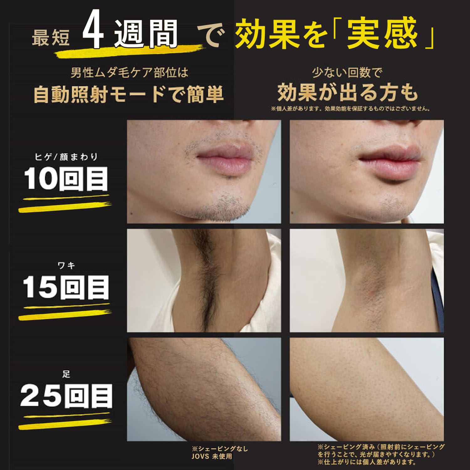 Amazon | JOVS Dora SRモード搭載 脱毛器 家庭用 光美容器 VIO対応 だ