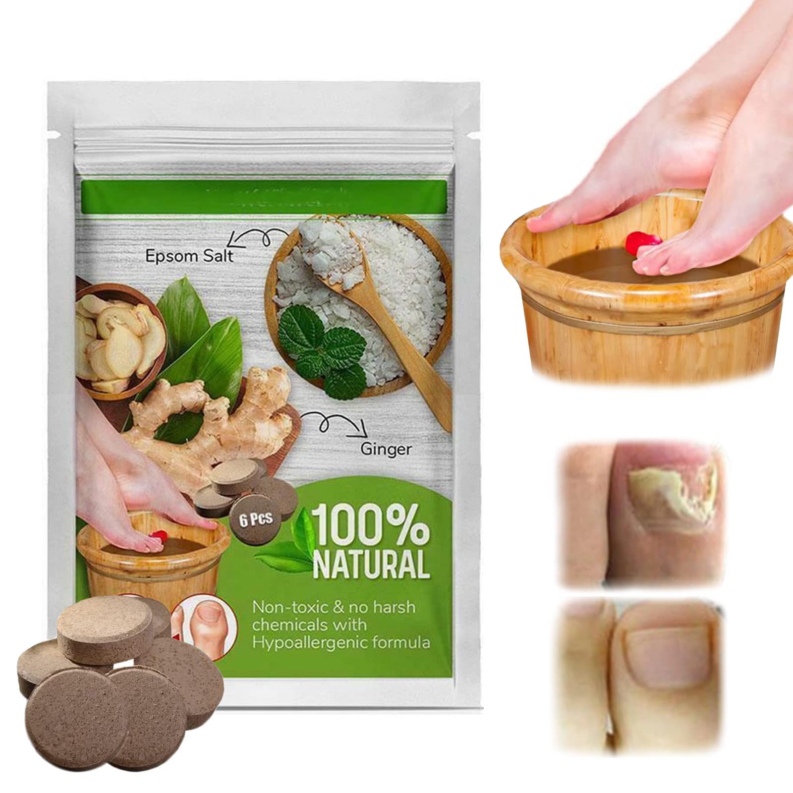 Buy Antifun_gal al Foot Soak, Lymphatic Drainage Ginger Foot Soak