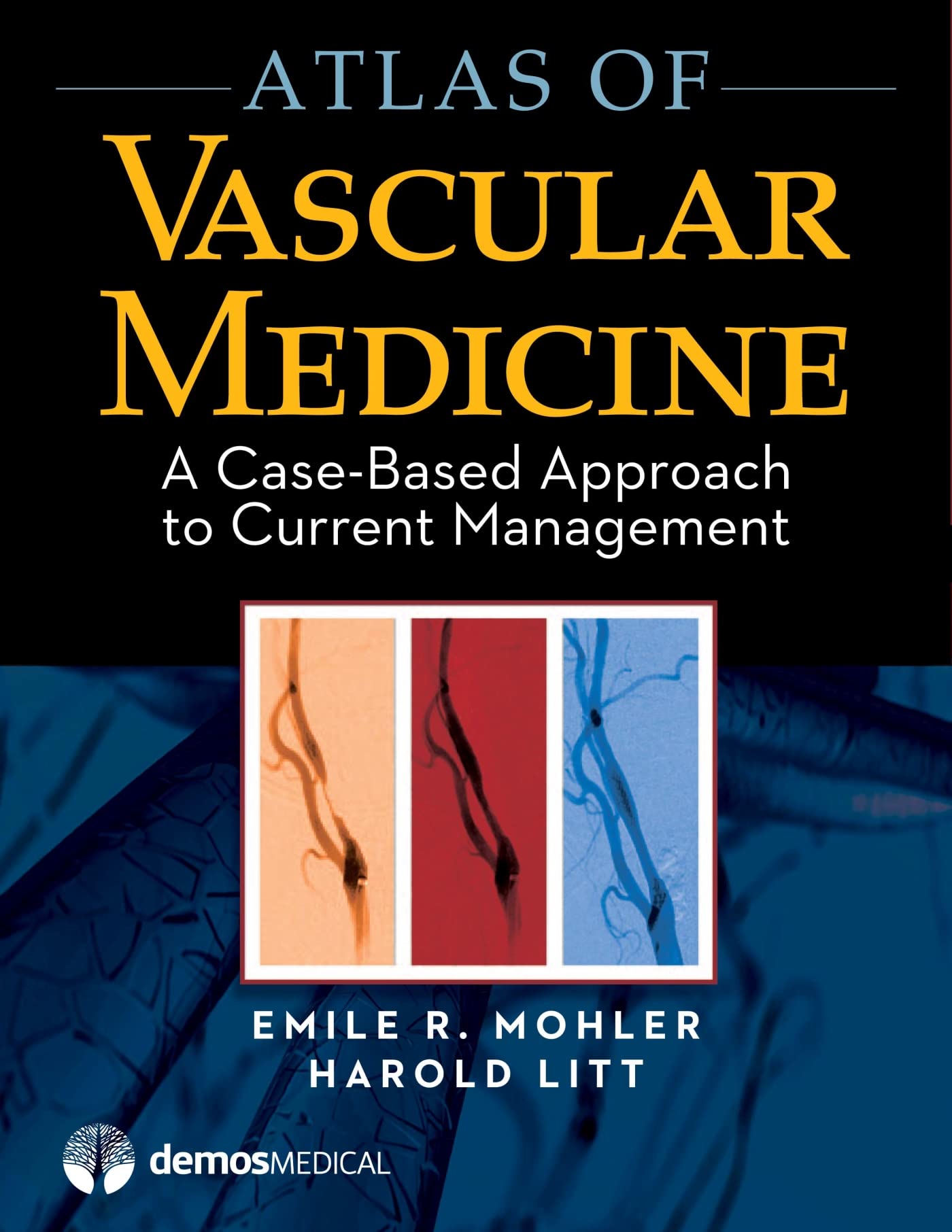 Atlas of Vascular Medicine: A Case-Based Approach to Current