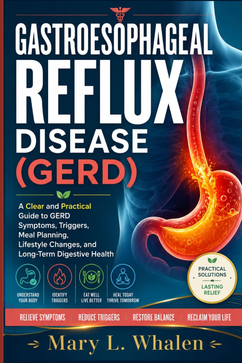 Gastroesophageal reflux disease (GERD): A Clear and Practical Guide to GERD Symptoms, Triggers, Meal Planning, Lifestyle Changes, and Long-Term Digestive Health