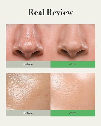 Miniatura 6 de Fully Crema facial de tomate verde, levantamiento de poros con 65% de extracto de tomate verde y vitamina C, hidratante facial para hidratación y