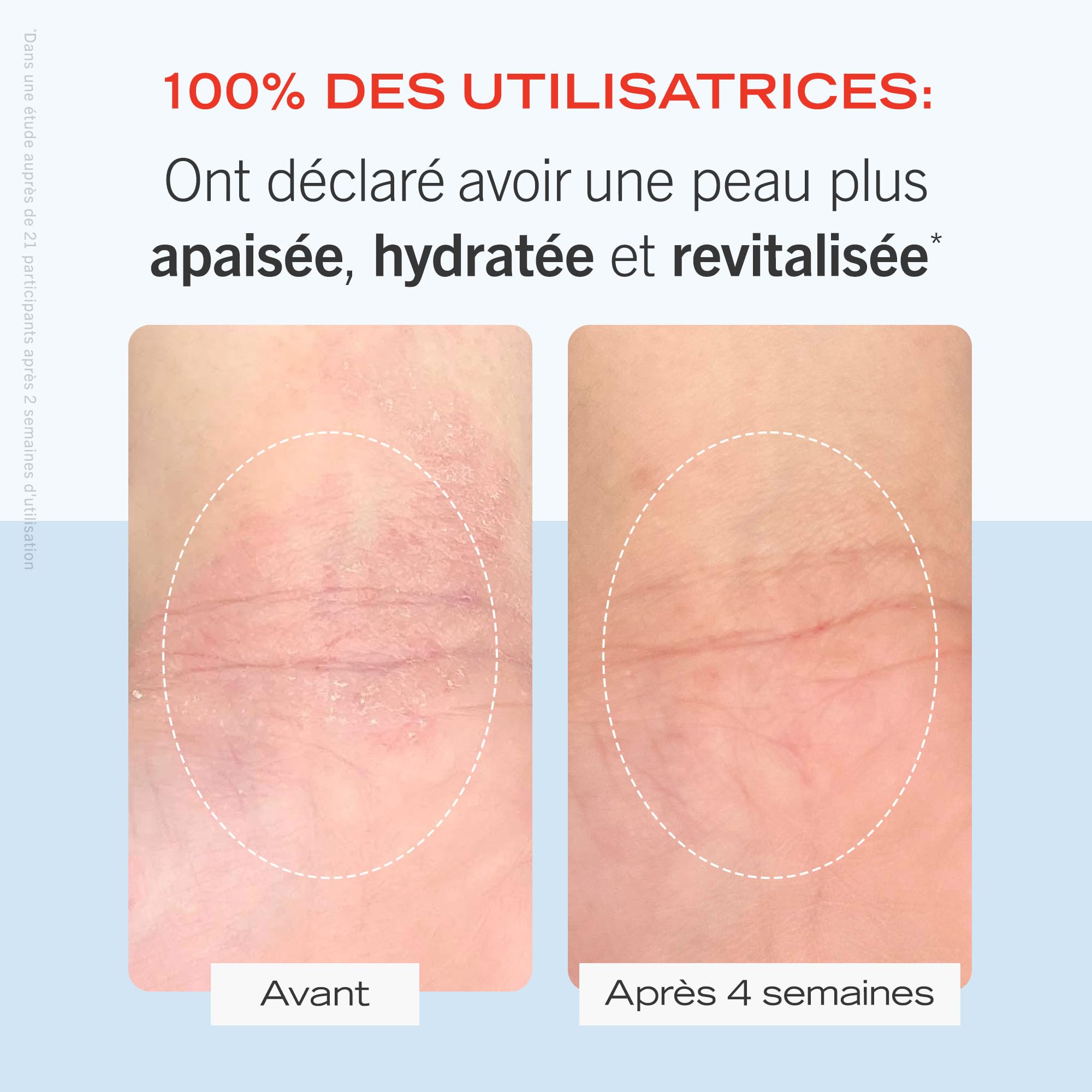First Aid Beauty FAB, Ultra Repair Cream, Crème Ultra Réparatrice, Crème Hydratante Intensive pour Visage et Corps (170 g), Protège et Restaure la Peau Grasse ou Sensible