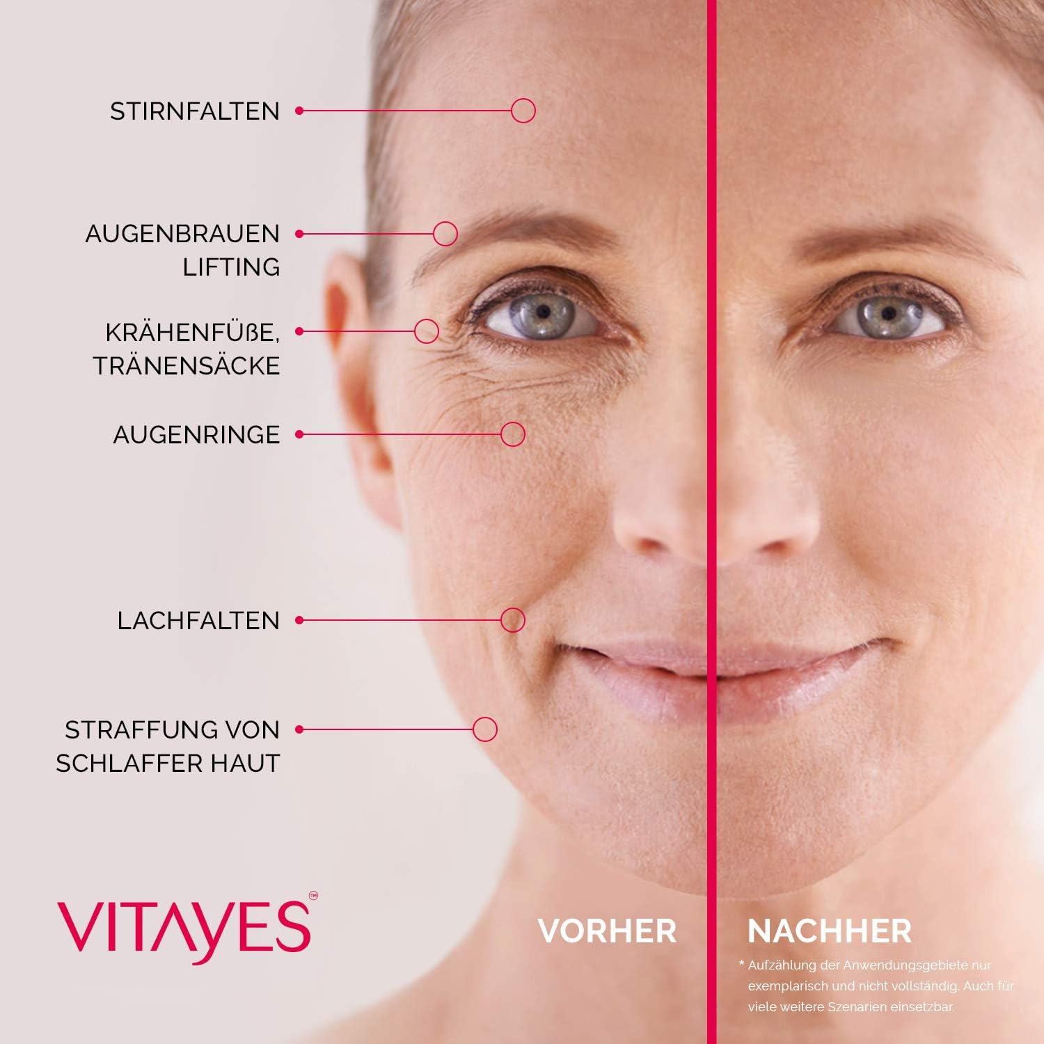 Vitayes Instant Ageback, Ageless facelift cream, anti aging cream, Instantly reduce under-eye bags, fine lines - Image 5