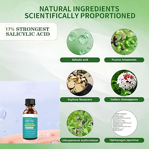 Miniatura 3 de AONARY Removedor TAG WART