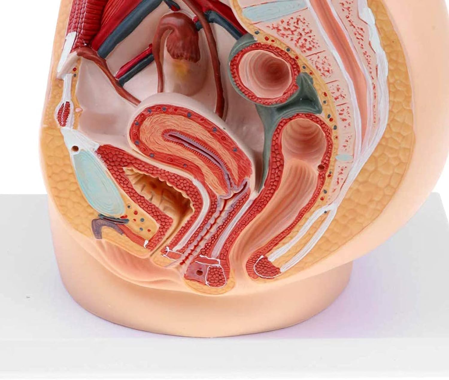 Model Anatomiczny Miednicy żeńskiej, Przekrój Strzałkowy Pośrodkowy, Ginekologiczne Zapalenie Gruczołu Krokowego Z Więzadłami, Naczyniami, Nerwami, Dnem Miednicy I Narządami, Do Szkoleń Med