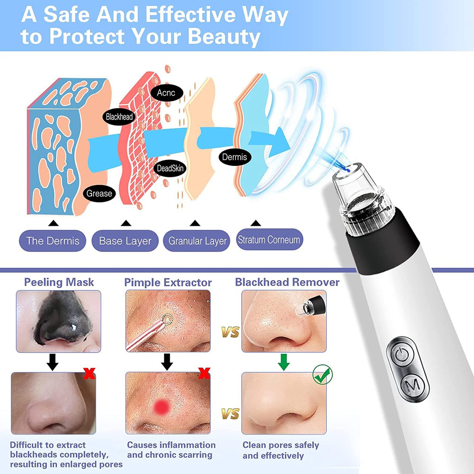 Limpiador facial de poros, limpiador eléctrico de poros, herramienta de succión de puntos negros, herramienta de extracción de puntos blancos, extractor de espinillas de limpieza facial, removedor de