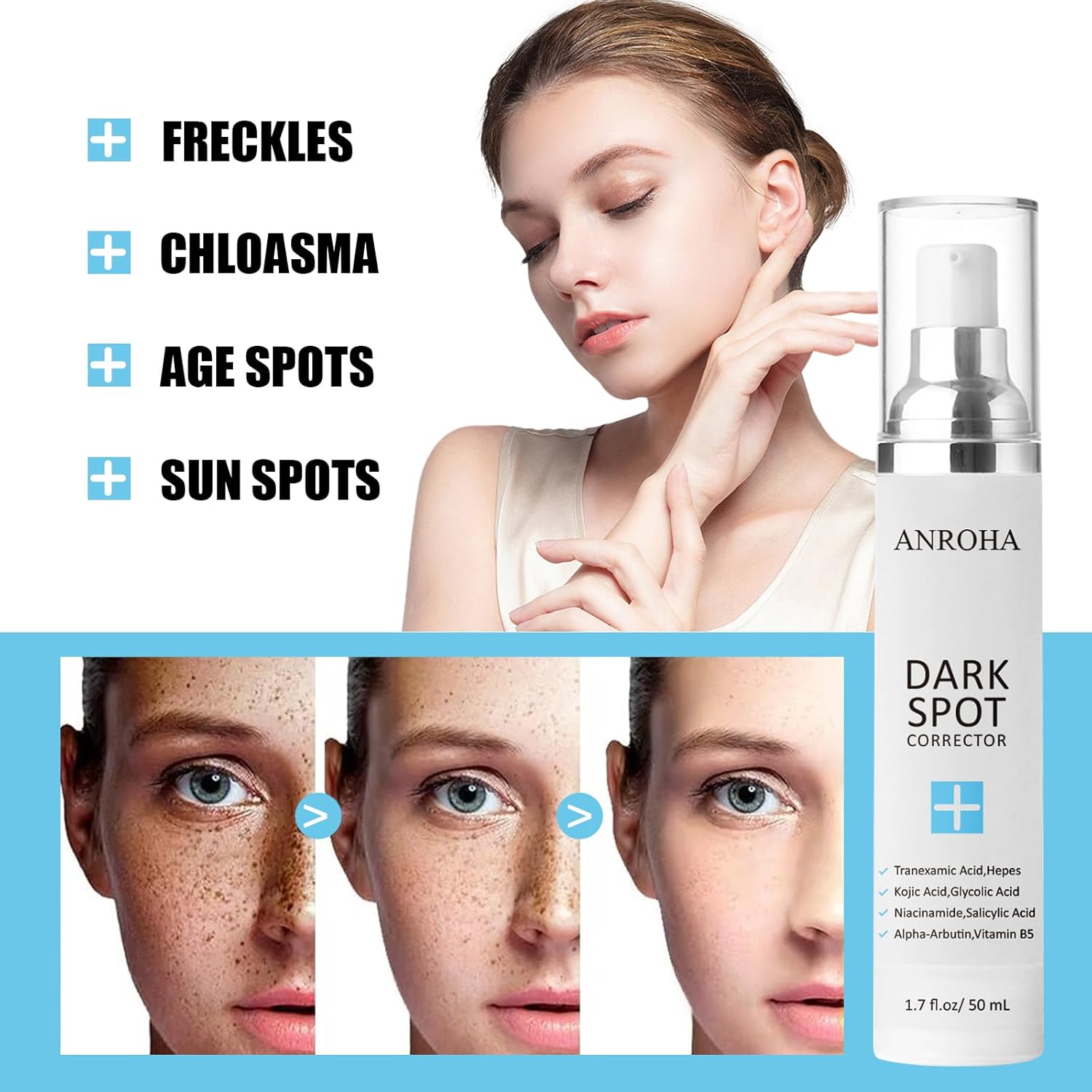 Dark Spot Remover for Face and Body Serum Promotes Anti-Aging Effect - Dark Spot Corrector for Women and Men with Niacinamide Kojic Acid & Salicyic Acid 50ml /1.7fl oz - Image 3