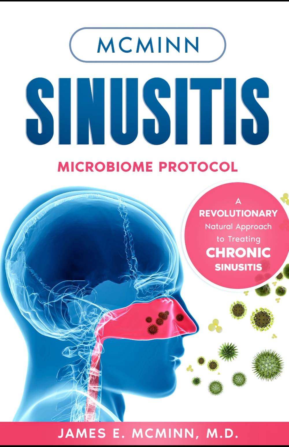 McMinn Sinusitis Microbiome Protocol: A Revolutionary Natural Approach to Treating Chronic Sinusitis