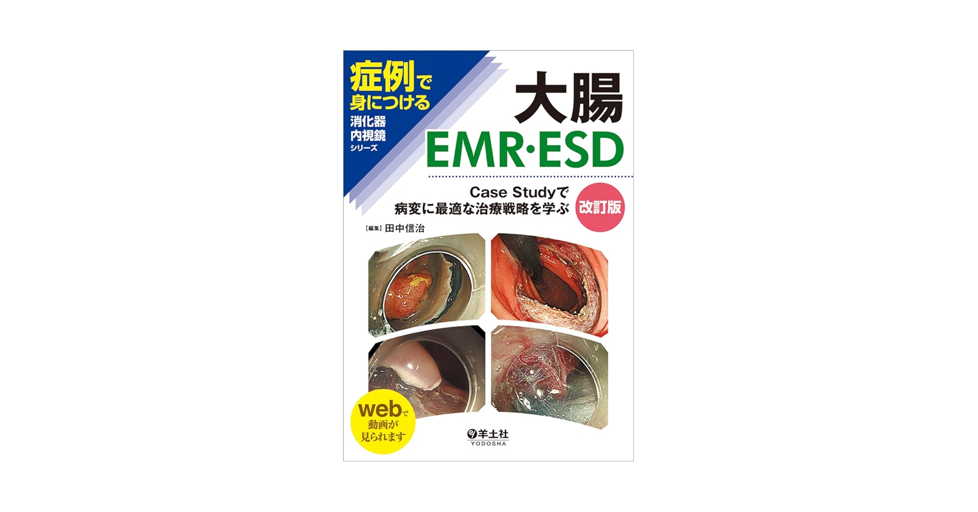 大腸EMR・ESD 改訂版〜Case Studyで病変に最適な治療戦略を学ぶ