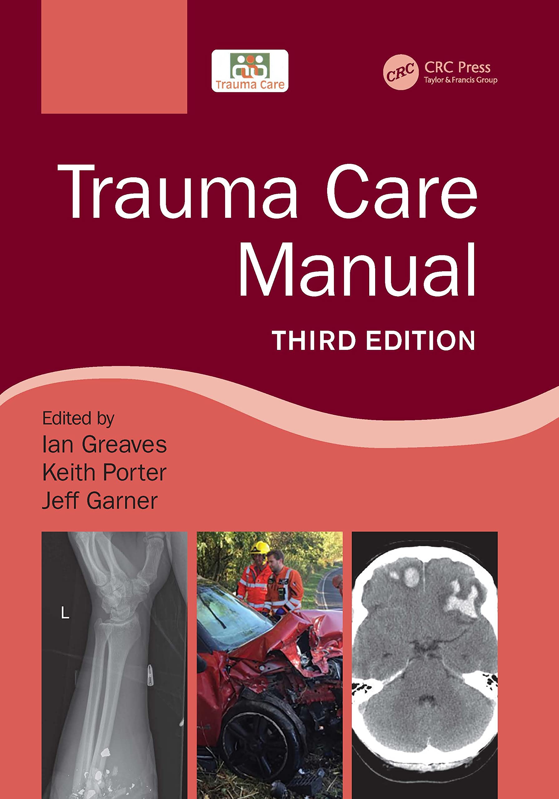 Trauma Care Manual Paperback – Import, 29 November 2021
