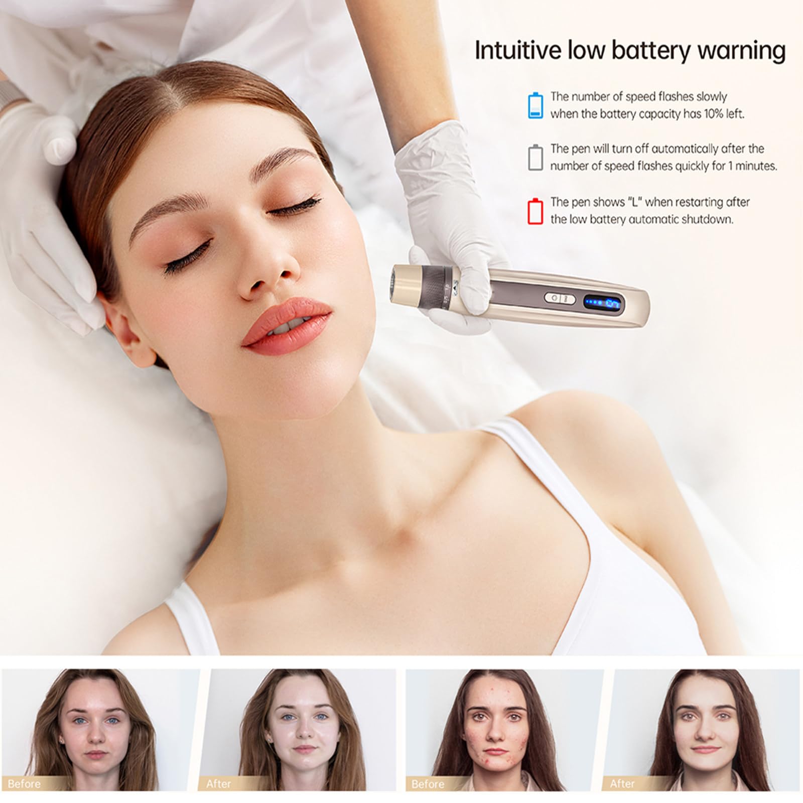 Microneedling-Pen mit 6 Geschwindigkeitsstufen B | EMS-Mikrostrom &automatische Serum-Infusion,30 Ersatzkartuschen,LED-Beauty-Tool für revitalisiertes und verfeinertes Gesicht