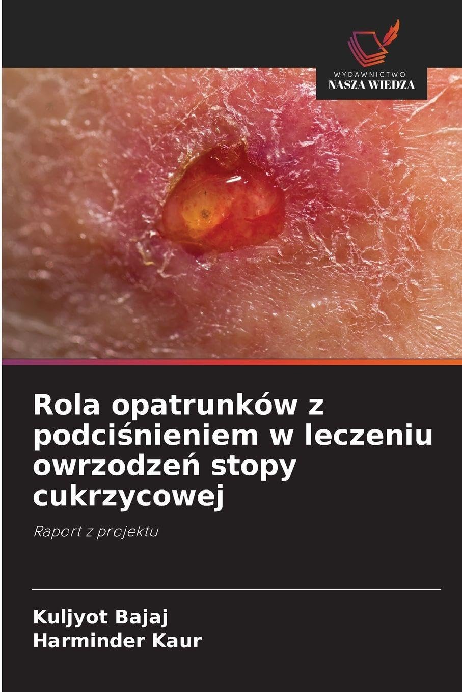 Rola opatrunków z podci¿nieniem w leczeniu owrzodze¿ stopy cukrzycowej: Raport z projektu