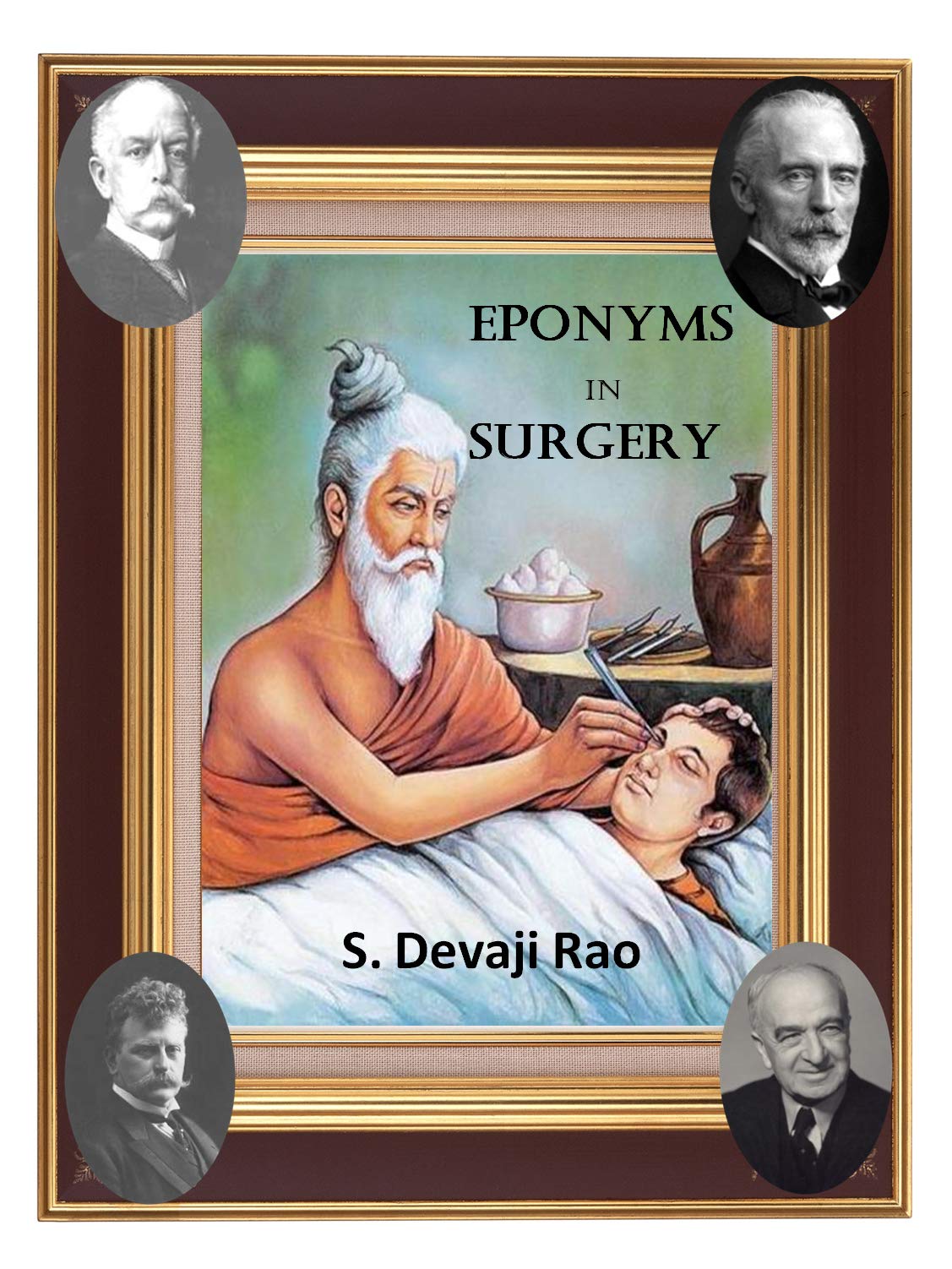 Eponyms in Surgery