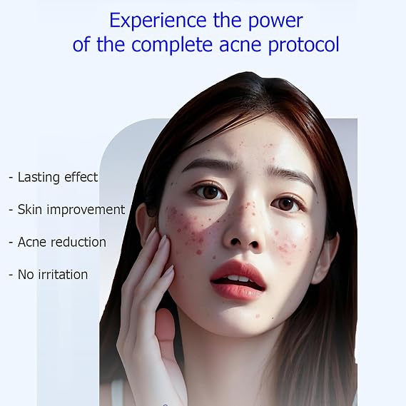BIOAQUA Acne Removal 3in1 Set Oil Control Cleanser Cream 30g+100g+30ml