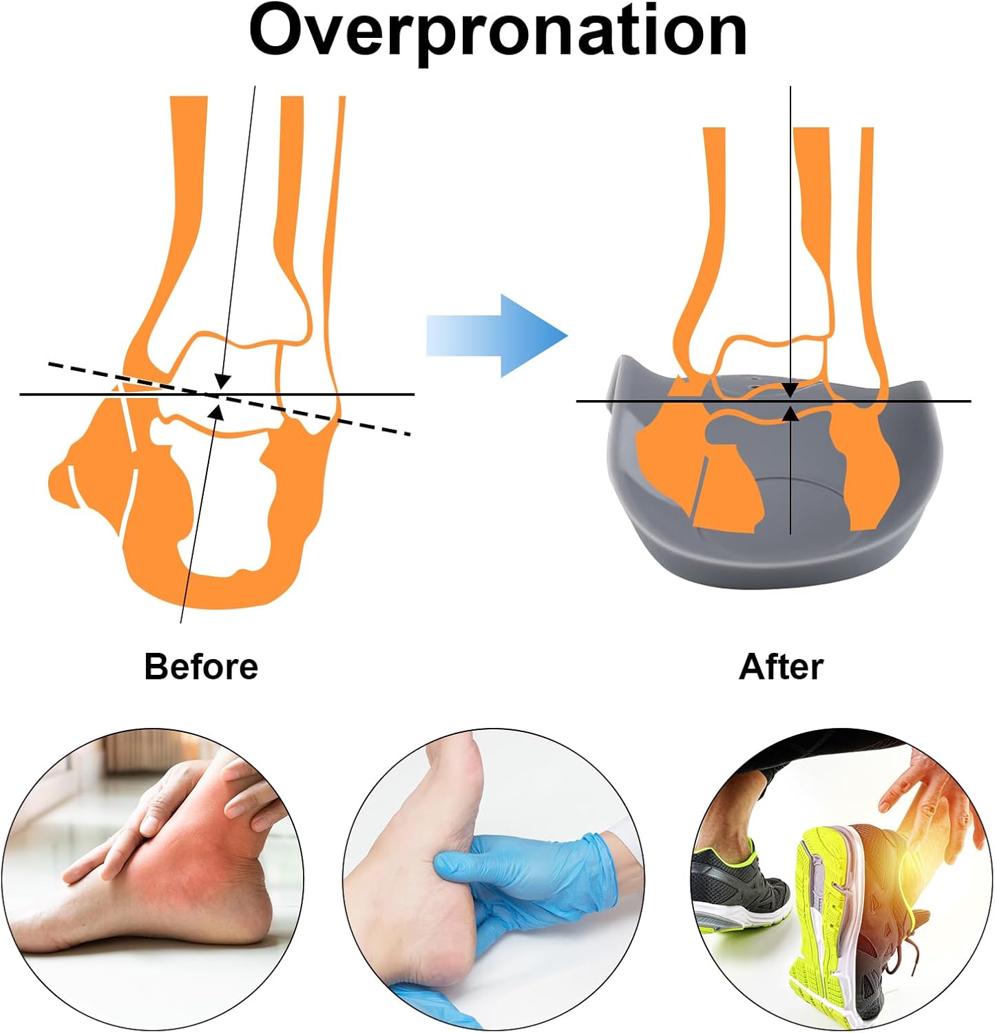 Original 3/4 Arch Support Metatarsal Support Orthotics Over-Pronation Insoles Relieve Plantar Fasciitis, Arch, Heel & Ankle Foot Pain (Gray, Men 6-8.5/Women 8-10.5) - Image 5