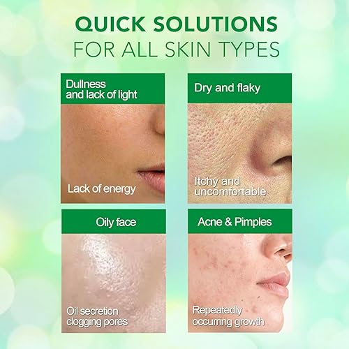 Miniatura 7 de TOTCLEAR Mascarilla de té verde para todas las piel removedor de puntos negros barra de limpieza profunda sin poros máscara facial de control de