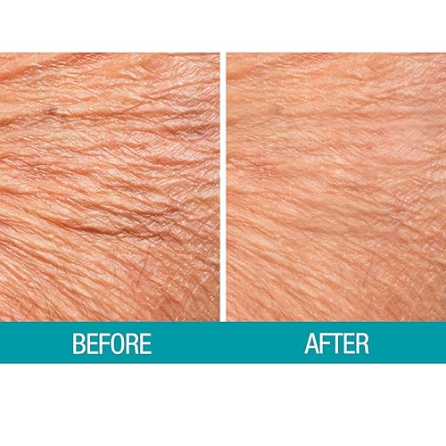 Miniatura 4 de Dermactin Crema reafirmante para la piel crepé 2.5 oz.