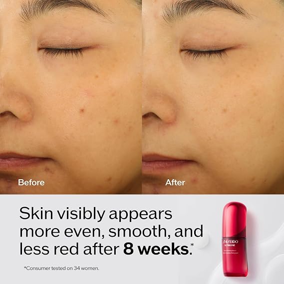 Shiseido UTM Power Infusing Concentrate 4.0 75 ml Cilt Serumu, 22446