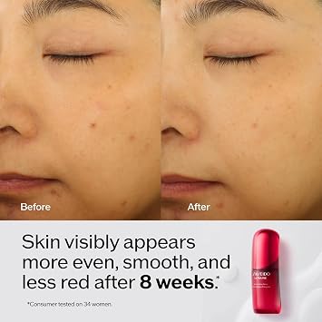 Shiseido UTM Power Infusing Concentrate 4.0 75 ml Cilt Serumu, 22446