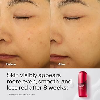 Shiseido Ultimune Power Infusing Serum - Breakthrough Lightweight Face Serum - Boosts Radiance & Improves Visible Signs of Aging - All Skin Types - Non-Comedogenic