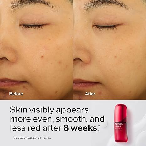 Shiseido Ultimune Power Infusing Serum - Breakthrough Lightweight Face Serum - Boosts Radiance & Improves Visible Signs of Aging - All Skin Types - Non-Comedogenic