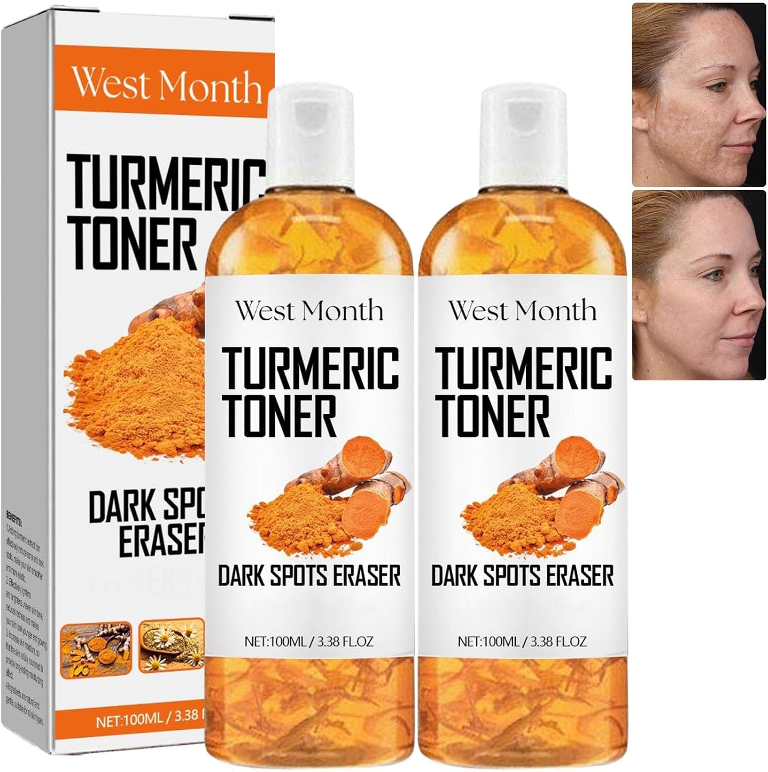 West Month Turmeric Toner Dark Spot Serum for Face, 100 ML Facial Serum for Women Anti Aging Fine Lines, Even Skin Tone (2Pcs)
