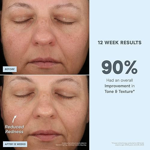 Miniatura 4 de NuFACE IonPlex Super Boosters