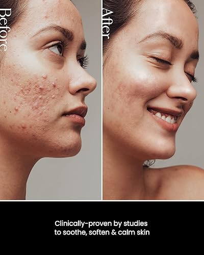 Miniatura 6 de SON&PARK Beauty Water Facia Mist  Tónico multiusos para control de aceite facial y corporal, hidratante, exfoliante, cuidado de la piel, potenciador