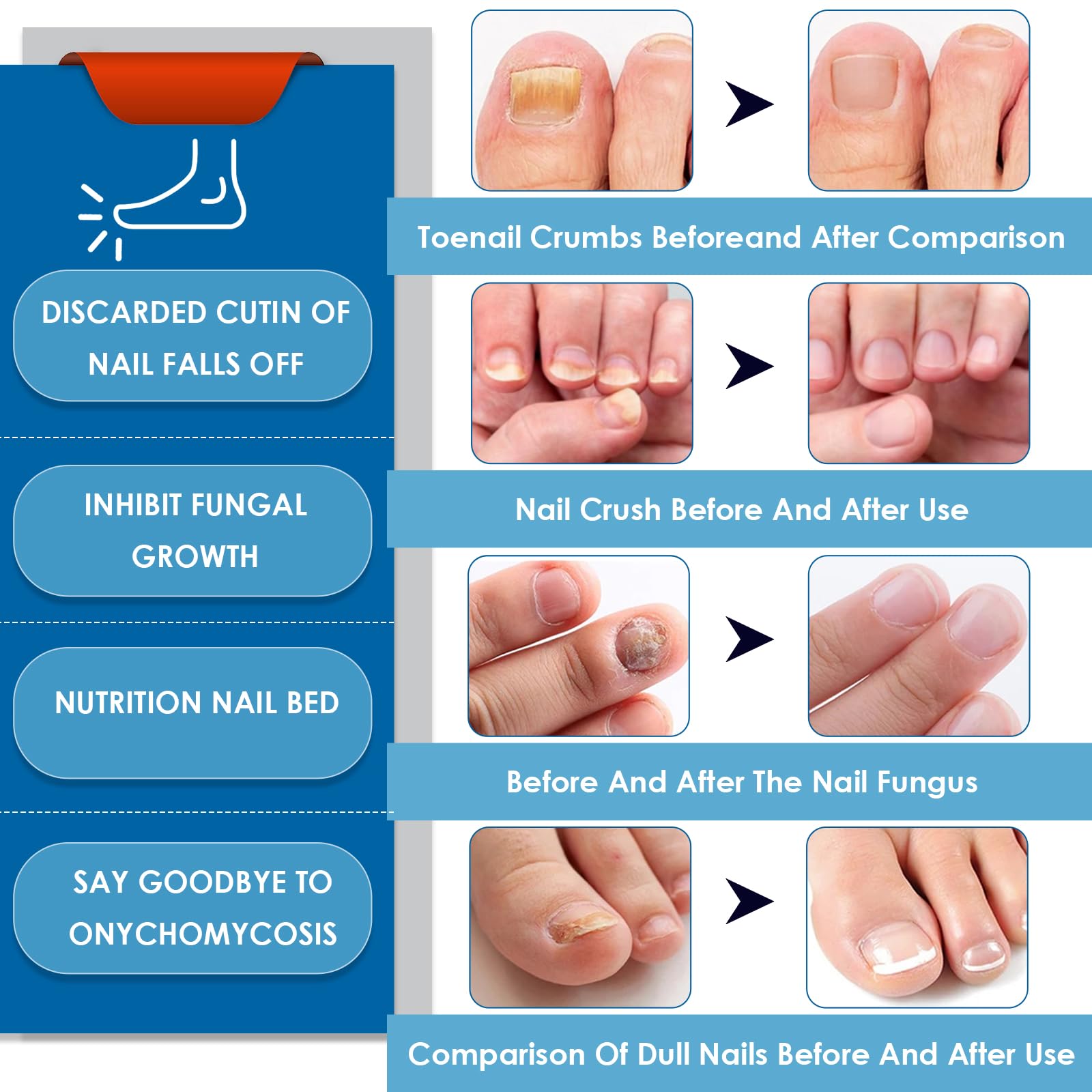 4 Pezzi Penna per la Cura Delle Unghie, Routine Nail Care Pen, Dell'unghia Nutre e Lenisce Le Unghim, Migliora l'aspetto Dell'unghia, Favorisce la Salute Delle Unghim