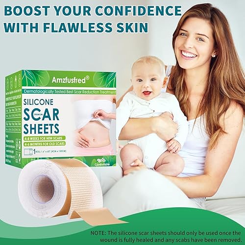 Miniatura 8 de Cinta de silicona para cicatrices actualizadas, hojas de cicatrices de silicona para cicatrices quirúrgicas, tira de cicatriz de silicona