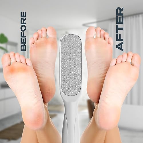 Miniatura 7 de Limas de talón para pies y piel áspera, removedor de callos y raspador de pies colosales, removedor de maíz de acción rápida para pies suaves