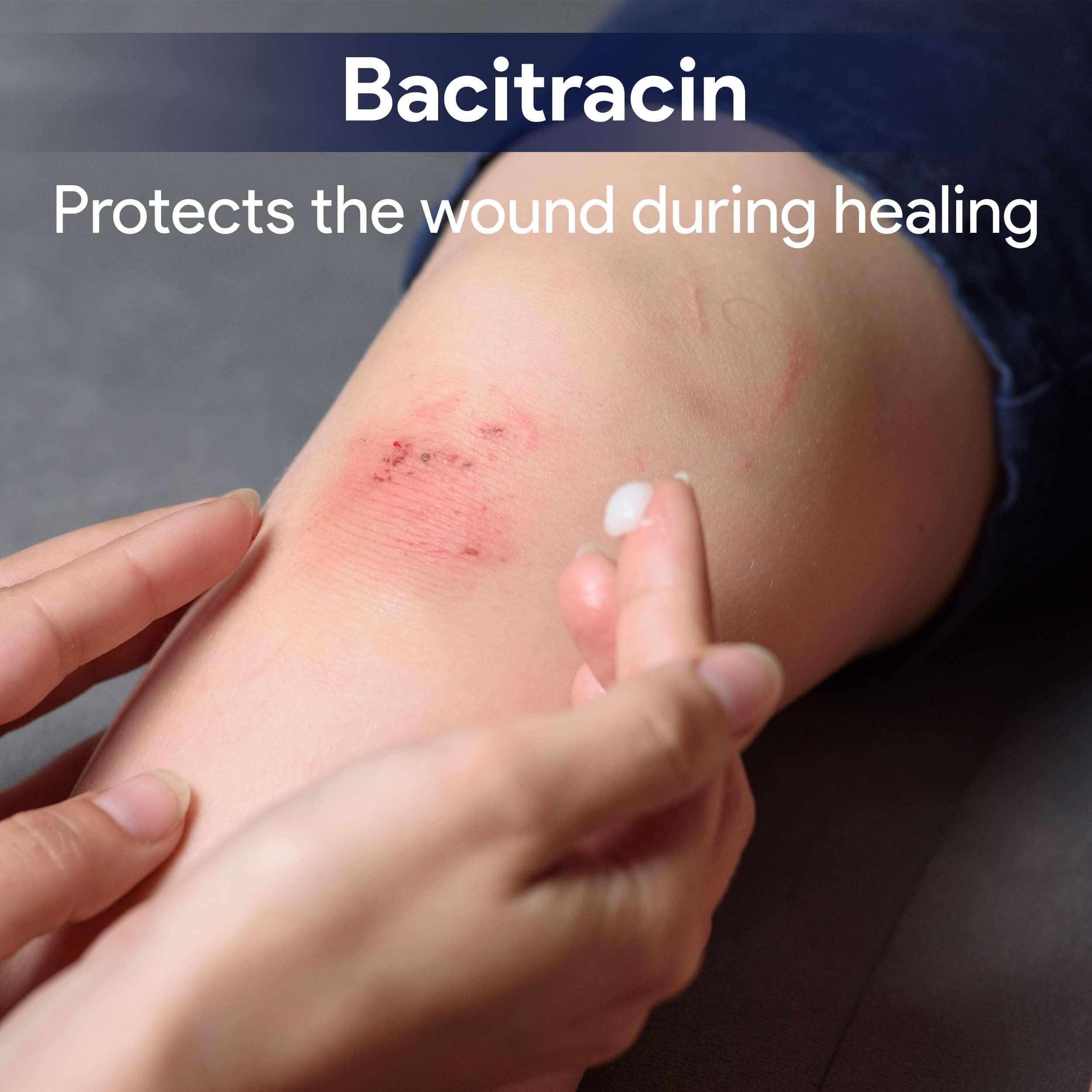 Bacitracin Antibiotic Ointment with Zinc, 1oz - First Aid Ointment for Minor Cuts, Bruises, Abrasions, Burns - Topical Antibiotic for Wound Healing — Amazon image 3
