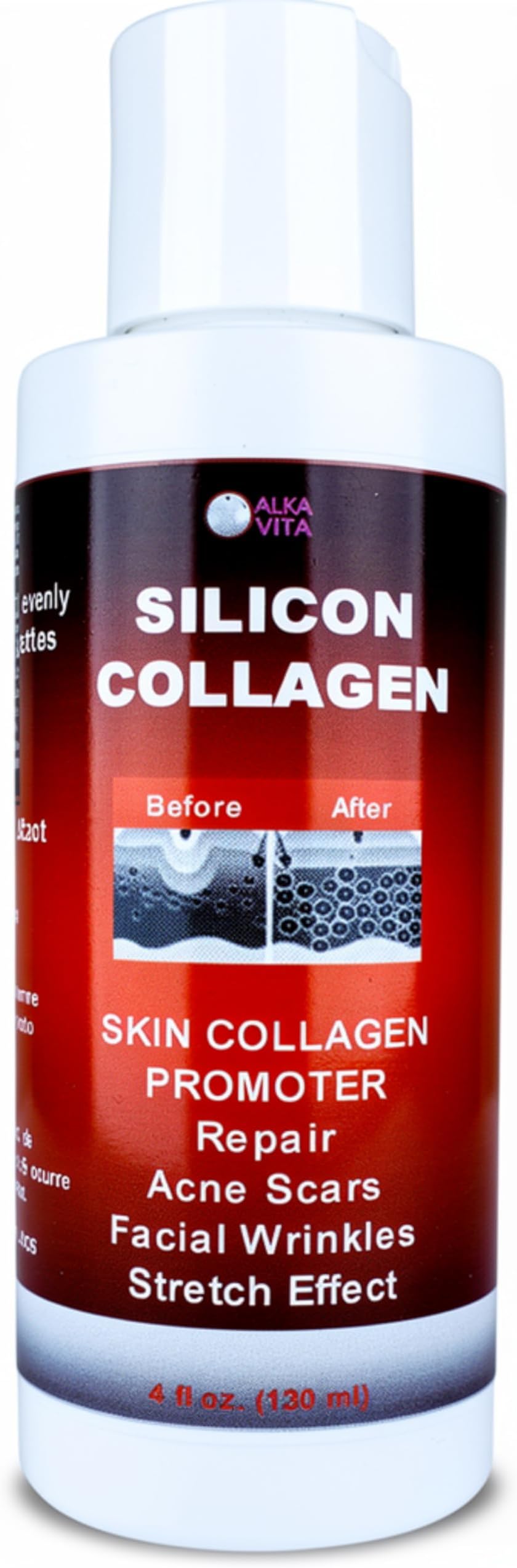 Acne Scars Silicon and Collagen Hydrolyzed Facial Gel Skin Resurfacing Indented By ALKA VITA