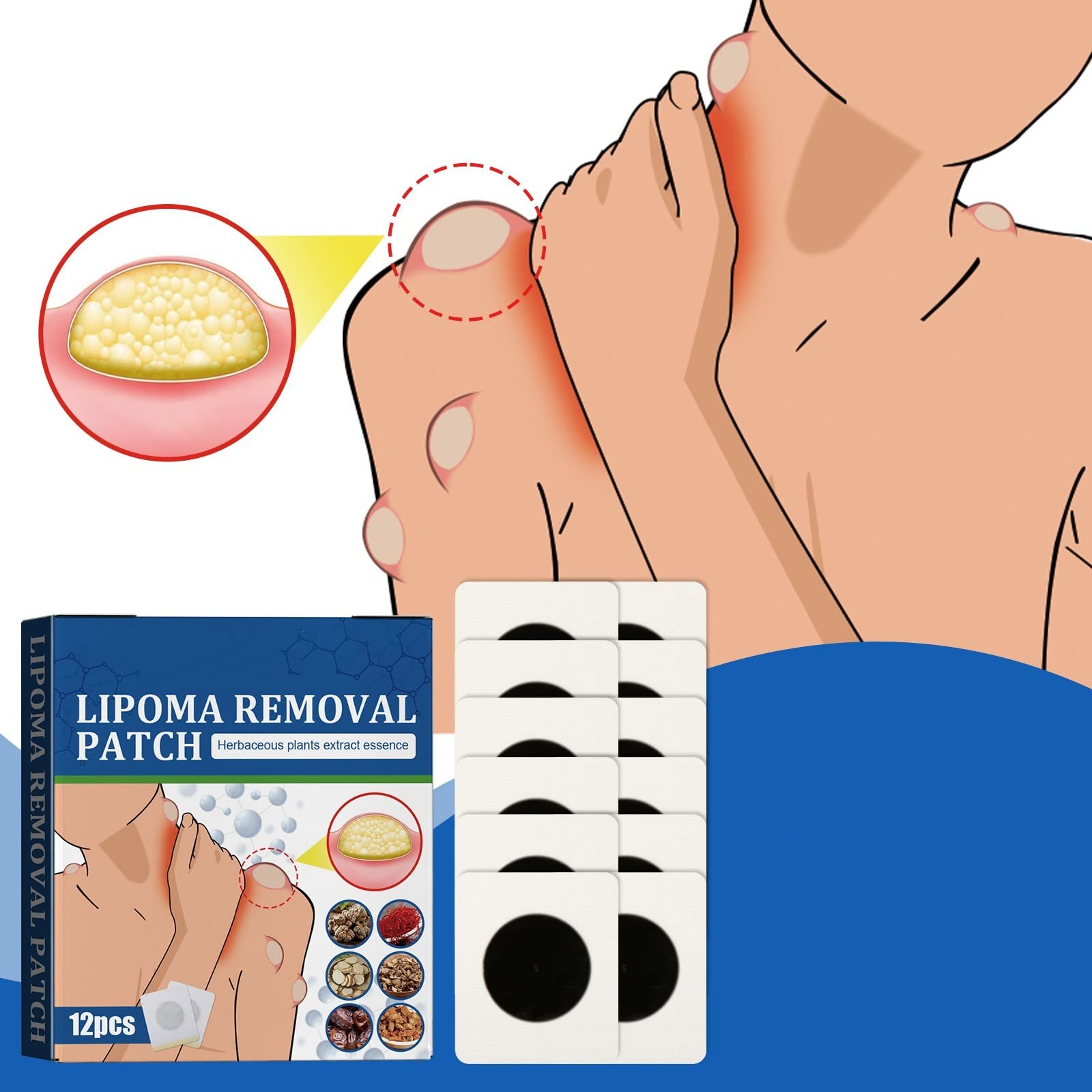 dhcprj Lipoma Removal Patches,Fast And Effective Natural Pure Herbal Lipoma Lumps Removal Patches For Get Rid Of Your Fatty Lipoma Lumps,Lipoma Removal Patches For Body