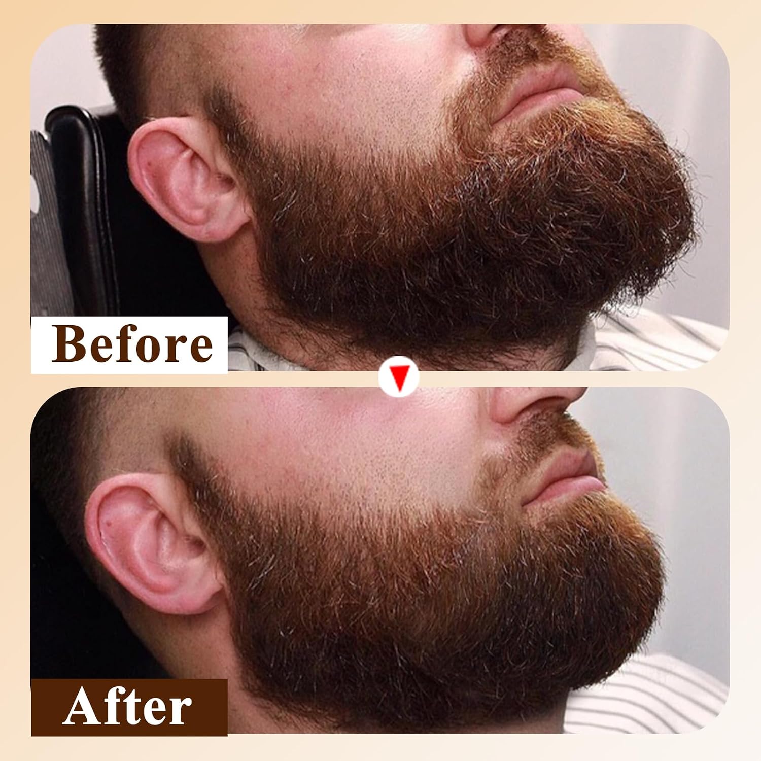 Varolan Beard Oil for Men,Natural Mens Beard Oil Capsules,Naturally Derived Conditioner with Argan Oil,Grapeseed Oil,Jojoba Oil and Vitamin E for Softening and Moisturizing Beard(Cedarwood)