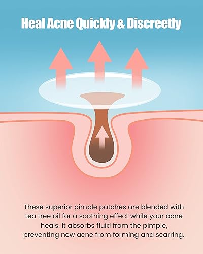 Miniatura 4 de Jefusst Parches para el acné (102 parches), parche hidrocoloide para el acné con ácido salicílico, parches para espinillas para la cara, parche