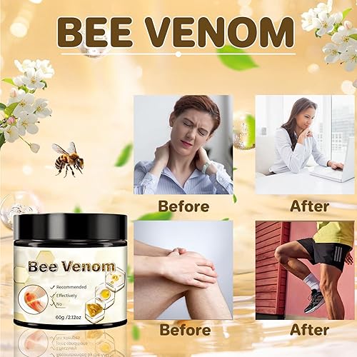 Miniatura 2 de 2 unidades de crema de veneno de abeja, crema avanzada de veneno de abeja, adecuada para espalda, cuello, manos, pies, etc