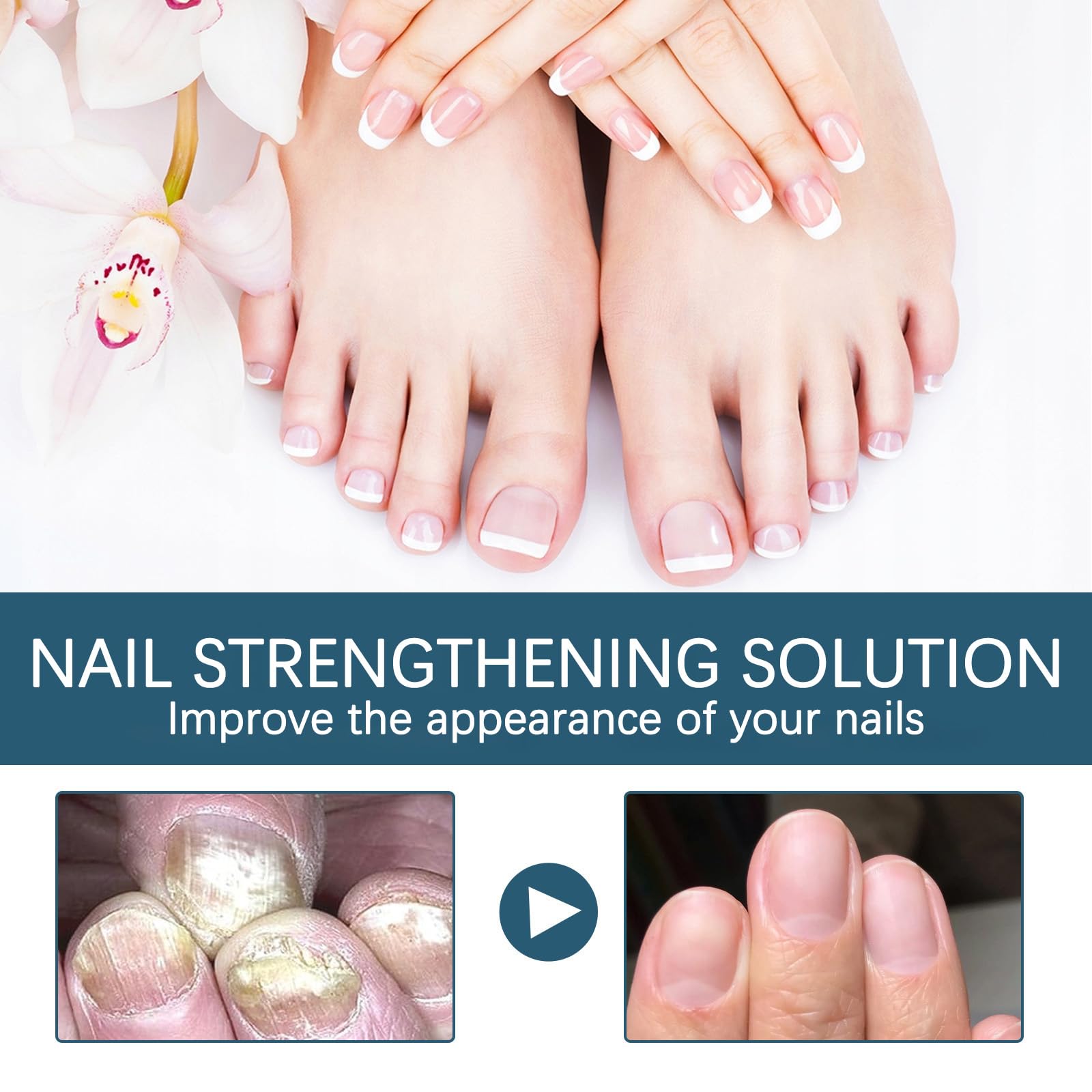 Extra Strong Nail Fungal Treatment for Toenail Anti Fungal Nail Extra Strong, Toe Nail Treatment ExtraStrong, Nails Repair - Image 4