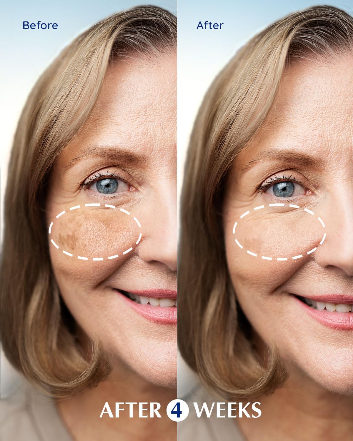 Dark Spot Remover for Face: EnaSkin Dark Spot Remover Rollerball - Travel Size Brightening Serum for Face & Body - Sun Spot Age Spots Freckles Melasma Brown Spot Remover for Women and Men (0.5 Fl Oz) - Image 4