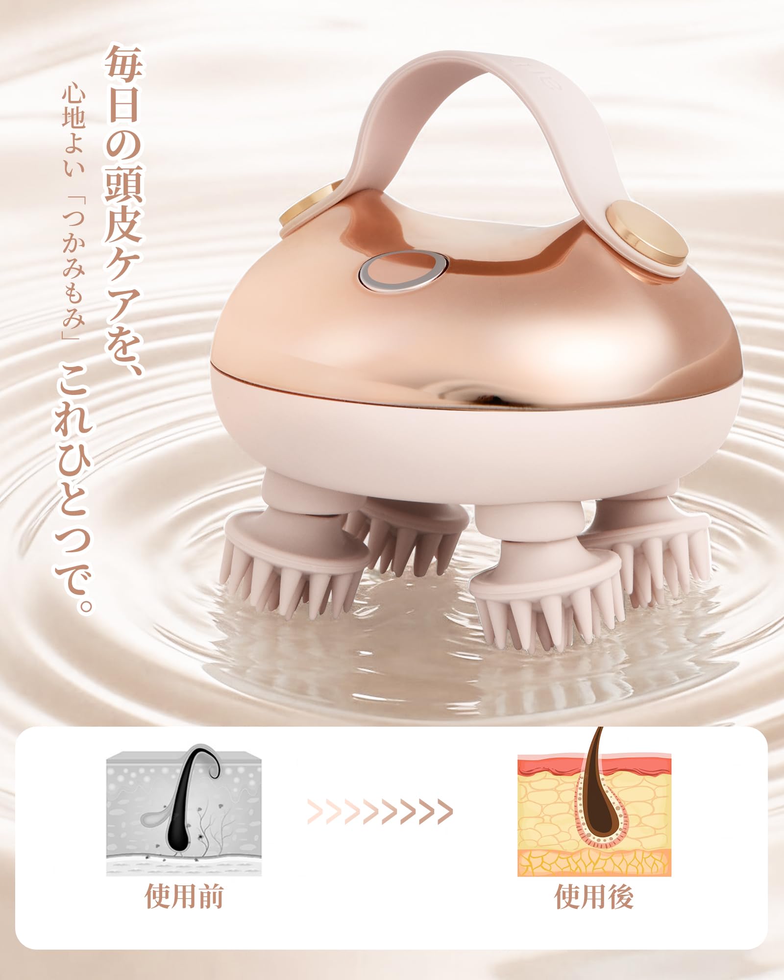 Amazon | arboleaf ヘッドスパ 電動頭皮ブラシ スカルプケア 頭皮洗浄 Amazon | arboleaf ヘッドスパ 電動頭皮ブラシ スカルプケア 頭皮洗浄