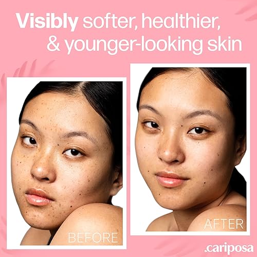 Miniatura 5 de Suero de ácido hialurónico para la cara, hecho de suero de ácido hialurónico puro, suero hidratante para mujeres, suero hialurónico que mejora la