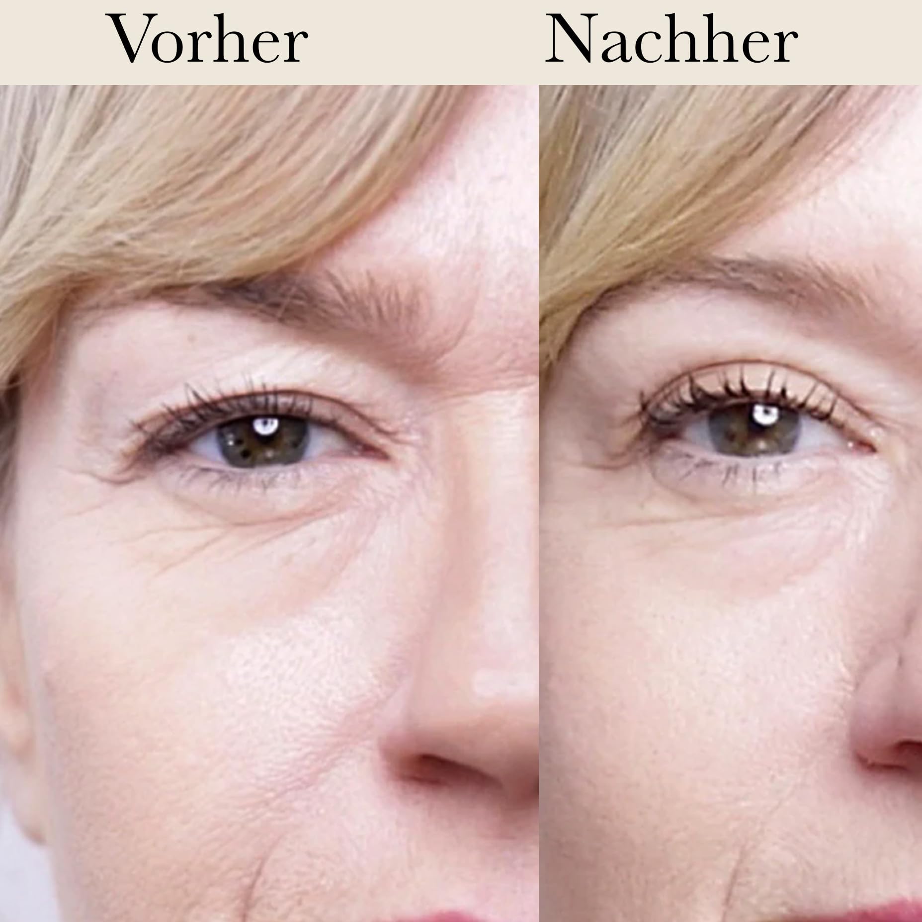 MAGICSTRIPES - Schlupflid Tape Augenlidlift & Lidkorrektur ohne OP, Transparente Augenlid Stripes für intensiven Lift & wachen Blick – 64 Stück (Größe L)