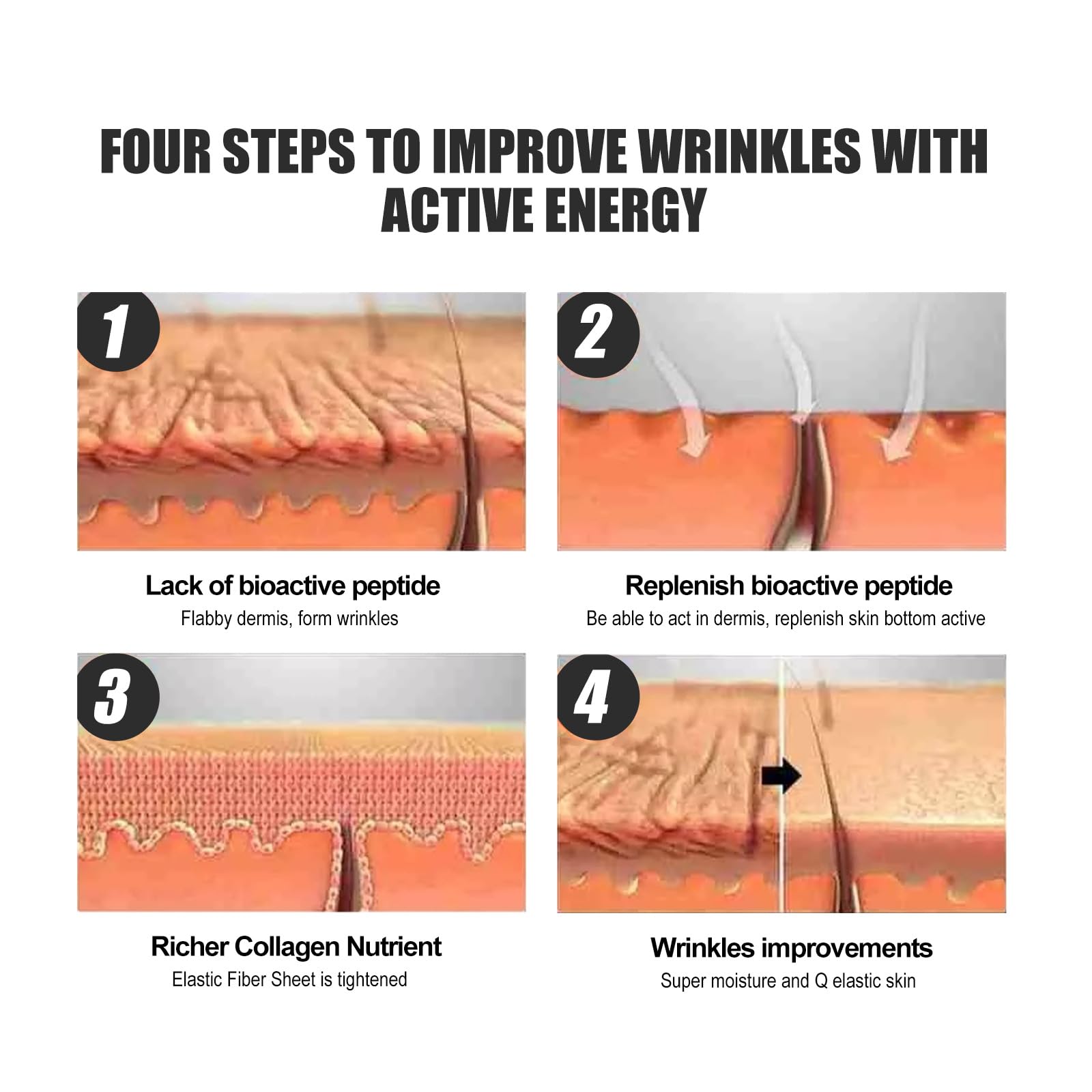 Nasolabial Wrinkle Patches, Anti-Wrinkle Pads - Image 4