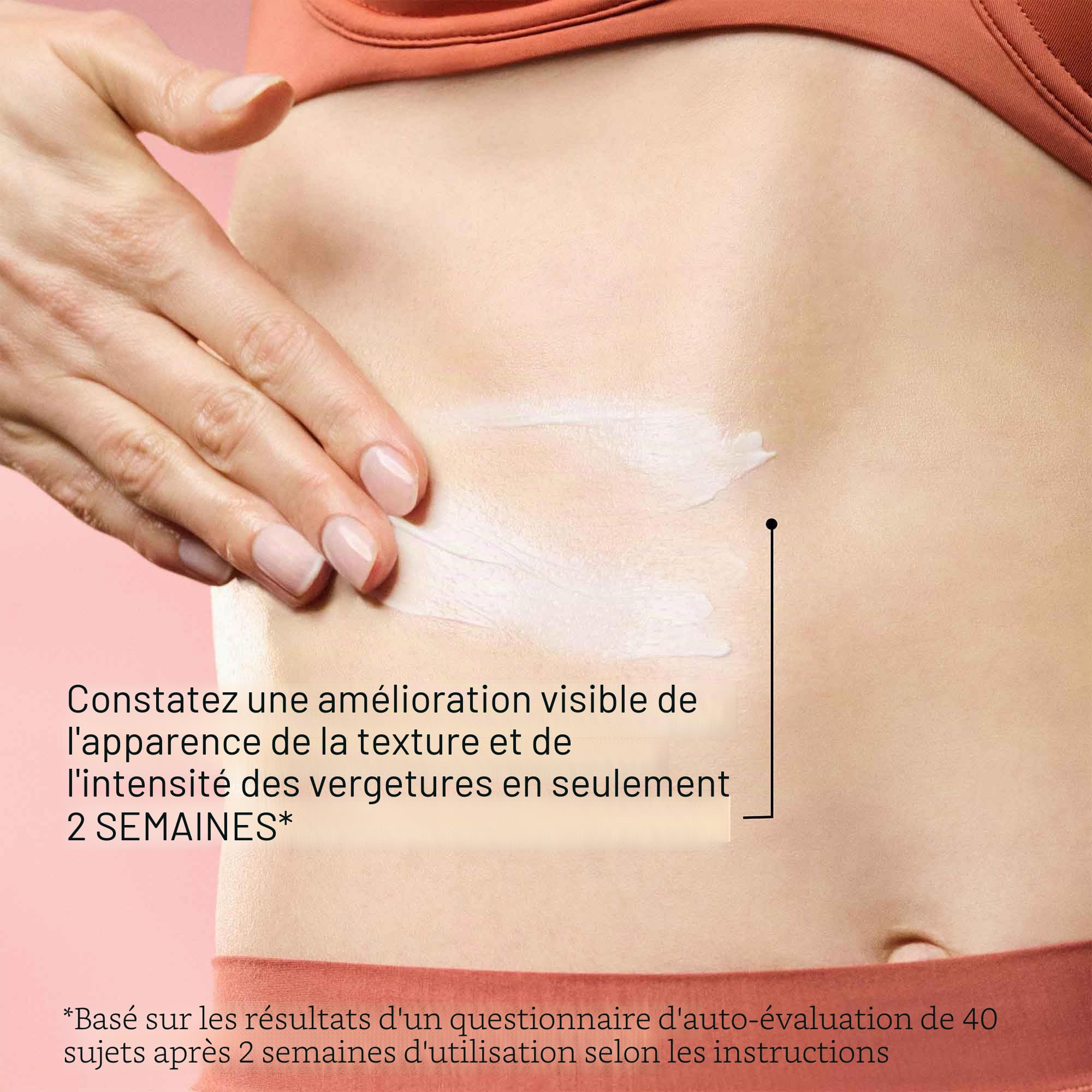 SD Advanced™ Plus Soin Hydratant Intensif Anti-Rides et Anti-Vergetures 118ml