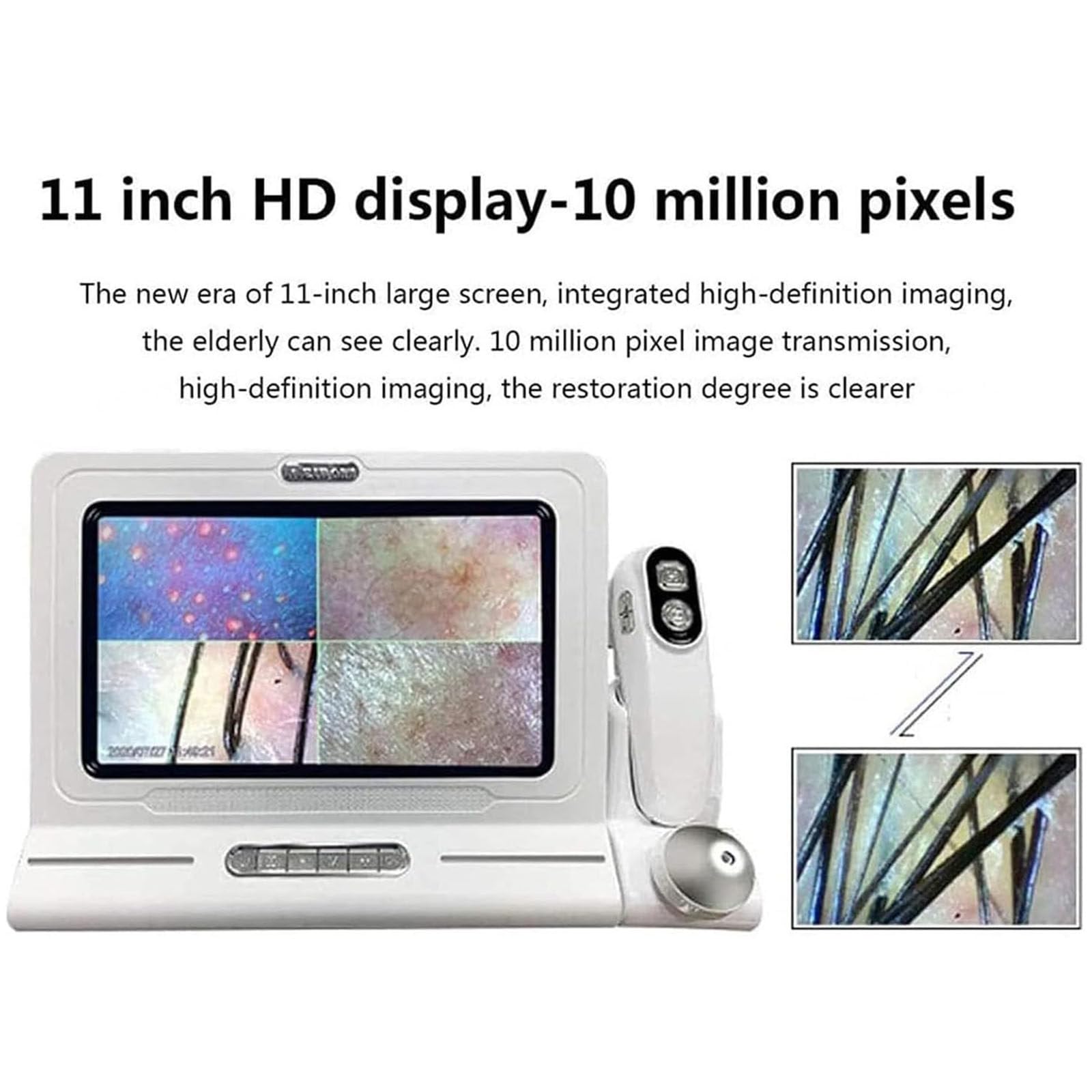 Analizzatore Capelli E Pelle Microscopio Digitale LCD 11 in Portatile per Rilevatore Cuoio Capelluto,Rilevatore di umidità Olio per Follicoli Piliferi Tester per Pigmenti Pelle