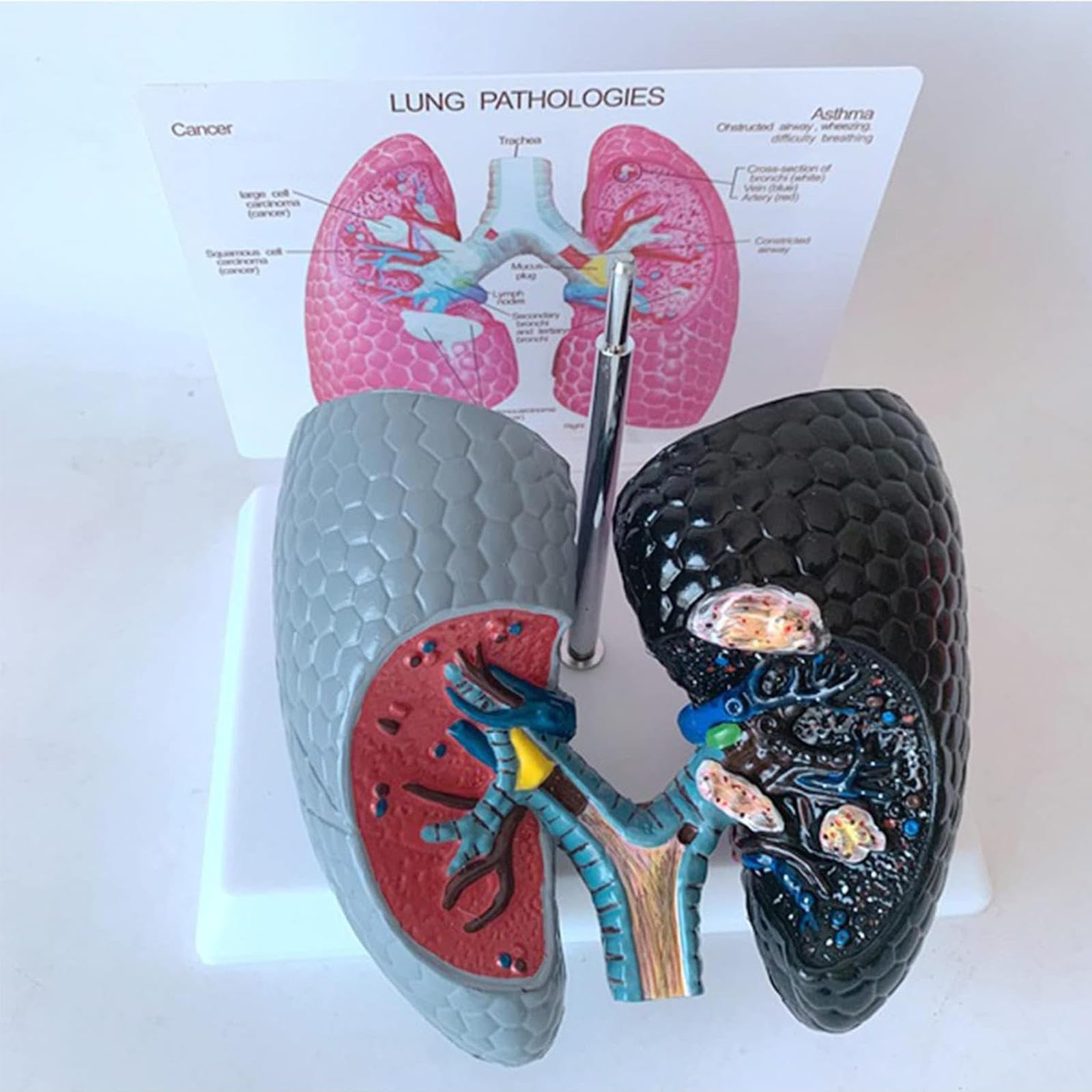 Mttxy Black Human Lung Model, Smoking Lung And Healthy Lung Model, Visceral Respiratory Pathology Comparison Demonstration For Classroom Teaching