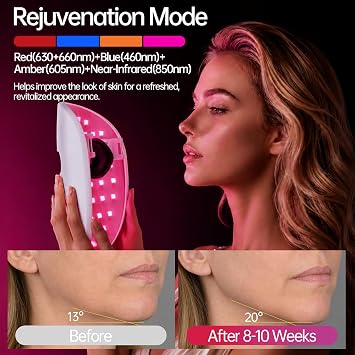 FDA Cleared Red Light Therapy Mask for Face, LED Face Mask with 4 Light Modes, 850nm NIR, 280 LEDs Dual Red Light for Anti-Aging & Acne Reduction - White