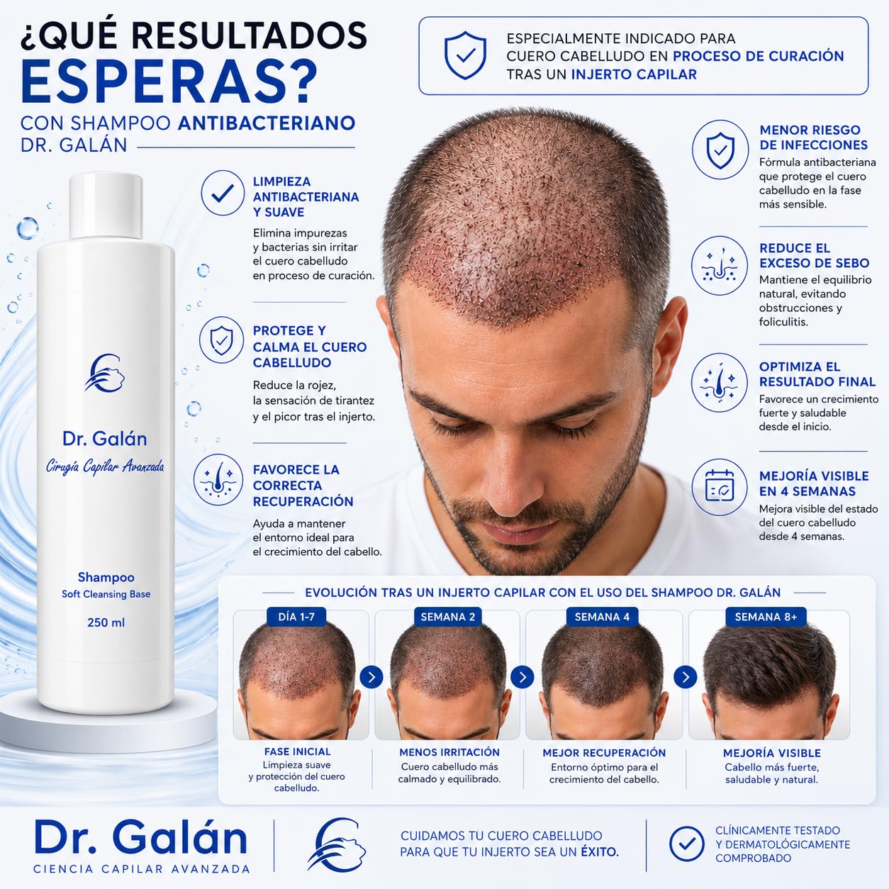 Pack Integral Postcirugía Capilar - Champú Post Injerto, Espuma Reparadora y Spray Calmante para Cuero Cabelludo Dañado - Tratamiento Completo