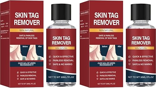 Skin Tag Remover with Salicylic Acid